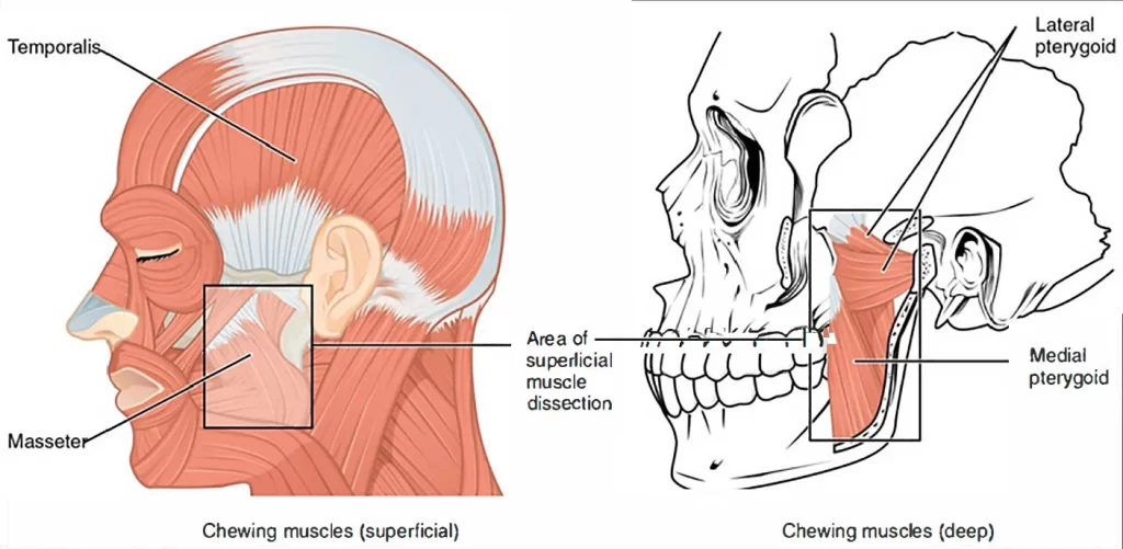 HeadNeck Diagram3